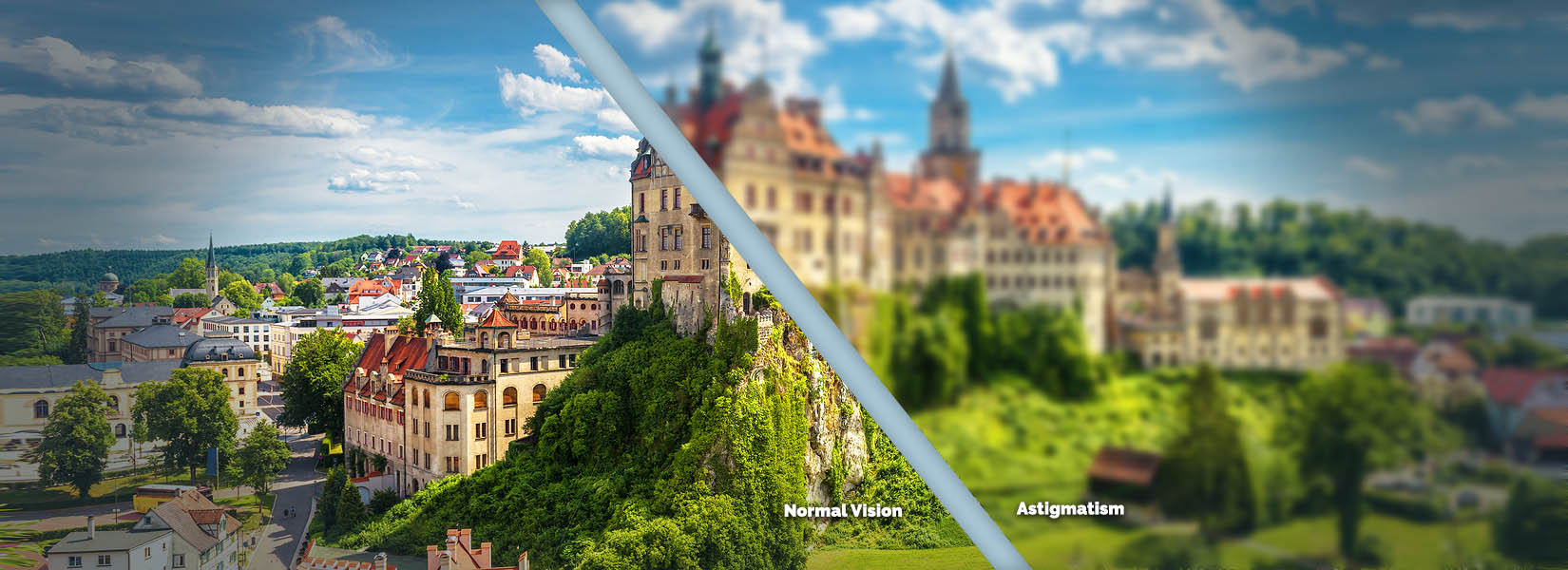 Astigmatism Treatment in Warsaw